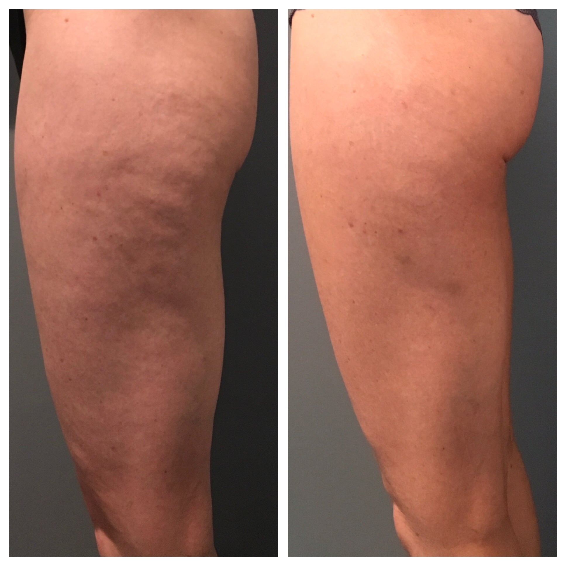 https://surfacemedicalesthetics.com/wp-content/uploads/2019/01/How-do-I-tighten-my-loose-skin-delle-chiaie.jpg