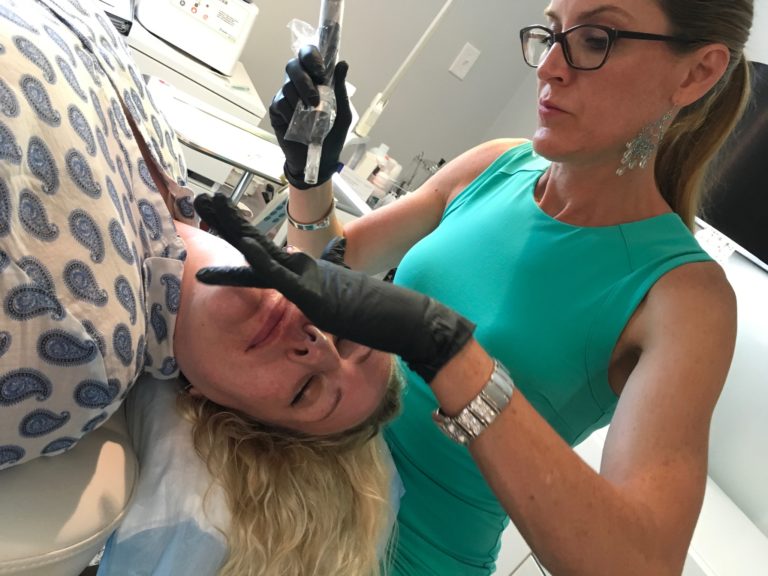 PRP treatments