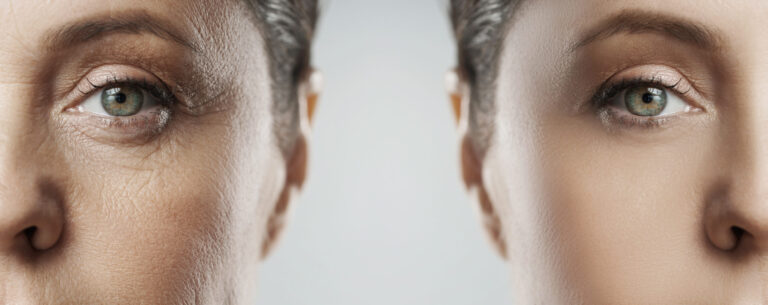 Growth Factor: the Most Beneficial Natural Skin Rejuvenation Treatment