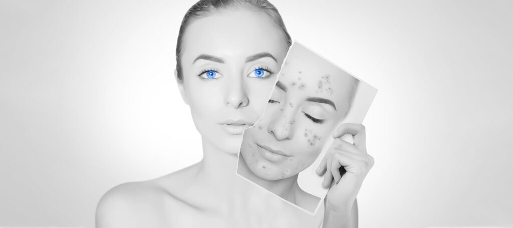 Teen Skin Health